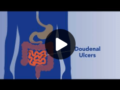 Peptic Ulcer Disease